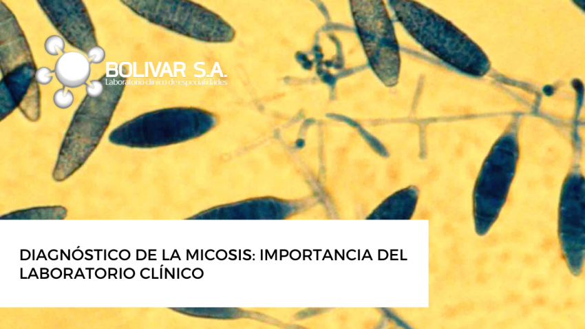 foto principal de DIAGNÓSTICO DE LA MICOSIS: IMPORTANCIA DEL LABORATORIO CLÍNICO 