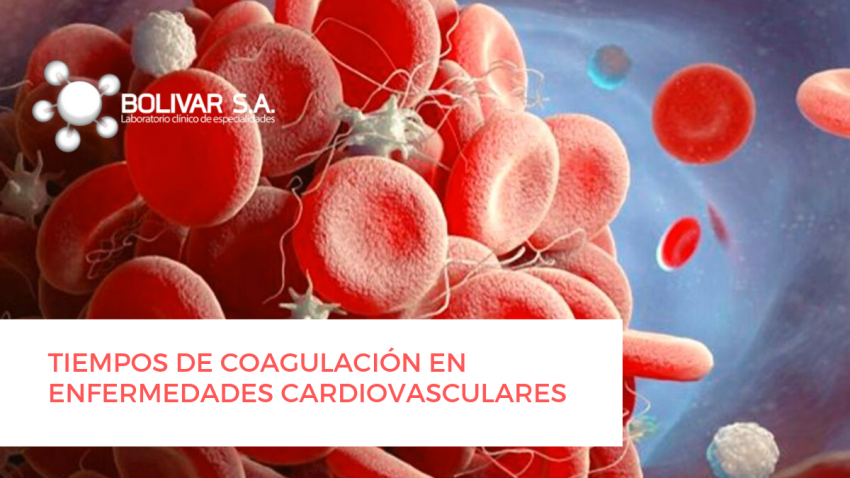 foto principal de TIEMPOS DE COAGULACIÓN EN ENFERMEDADES CARDIOVASCULARES