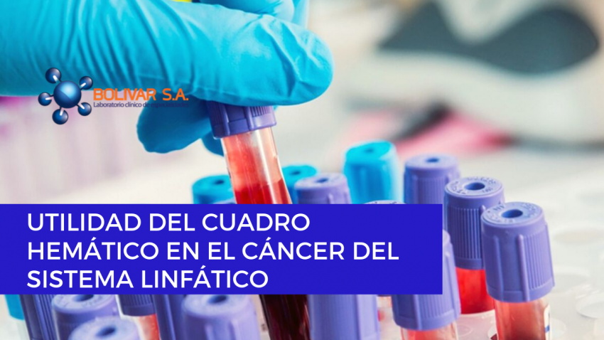 foto principal de UTILIDAD DEL CUADRO HEMÁTICO EN EL CÁNCER DEL SISTEMA LINFÁTICO